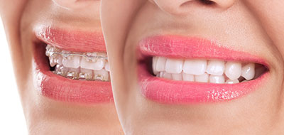 A woman s smiling face with pink lipstick, captured from two different angles.