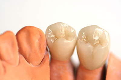 The image shows two artificial teeth with visible enamel-like texture placed side by side next to a human tooth, all set against a neutral background.