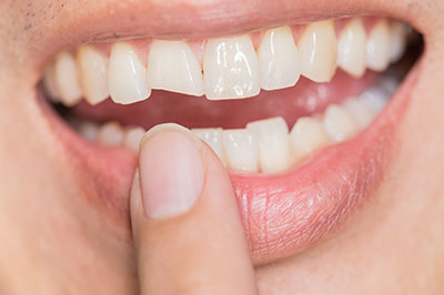 The image shows a person with a wide smile revealing white teeth, holding their index finger up to their mouth, which appears to be a close-up shot.