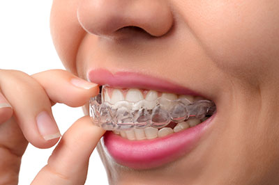 The image shows a person with braces in their mouth, holding a toothpaste tablet between their teeth, seemingly about to brush their teeth.