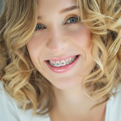 Woman with straight white teeth, smiling at camera, wearing braces, against light background.