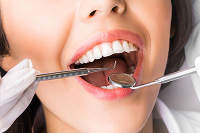 A woman with open mouth, receiving dental treatment with a dentist s hand holding a dental tool, wearing gloves and a mask.